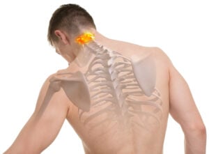 Cervical Fracture